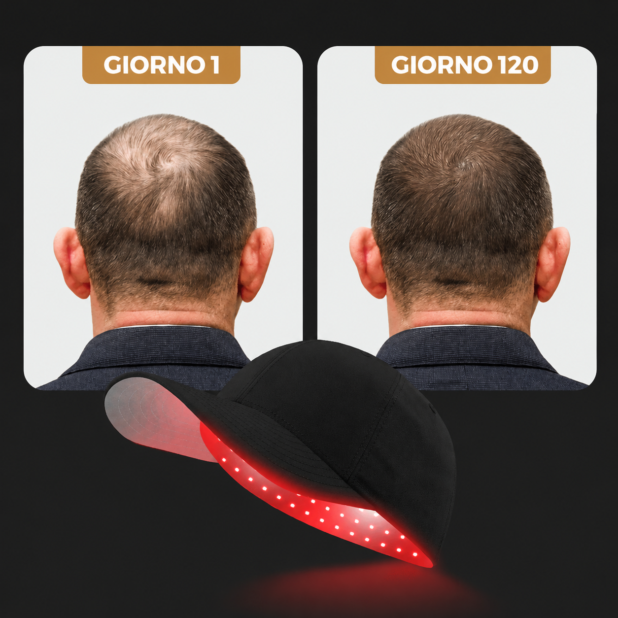 FOLLIGEN™ Cappello a Luce Infrarossa — Hai provato tutto. Il problema non erano i prodotti
